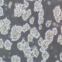 SK-NEP-1人肾母细胞瘤细胞(提供STR鉴定报告)