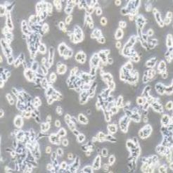 RL95-2人子宫内膜癌细胞(提供STR鉴定报告)