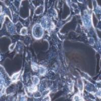 RD人横纹肌肉瘤细胞(提供STR鉴定报告)