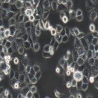 PANC-1人胰腺癌细胞(提供STR鉴定报告)