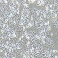 SK-MEL-2人皮肤黑色素瘤细胞(提供STR鉴定报告)