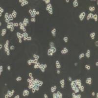 RAMOS人B淋巴细胞瘤细胞(提供STR鉴定报告)