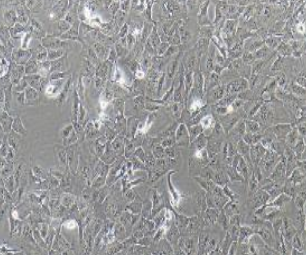 RBE人肝胆管癌细胞(提供STR鉴定报告)