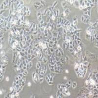 SBC-2人小细胞肺癌(提供STR鉴定报告)