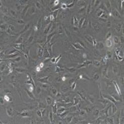 SK-OV-3+luc人卵巢癌细胞荧光素酶标记