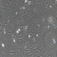 SK-OV-3+luc人卵巢癌细胞荧光素酶标记