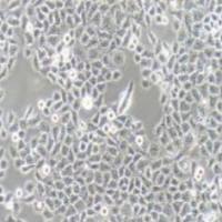 SMMC-7721人肝癌细胞(提供STR鉴定报告)