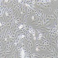 SiHa人子宫颈鳞癌细胞(提供STR鉴定报告)
