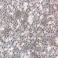 PANC-1/GEM人胰腺癌细胞吉西他滨耐药株