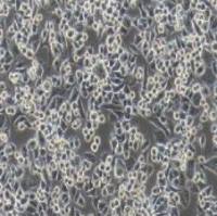 SK-BR-3+luc 人乳腺腺癌细胞+luc