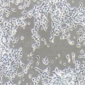 SH-SY5Y人神经母细胞瘤细胞(提供STR鉴定报告)