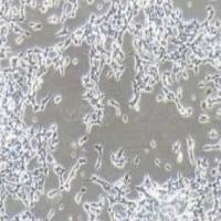 SH-SY5Y人神经母细胞瘤细胞(提供STR鉴定报告)