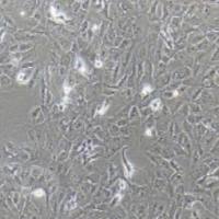 RBE人肝胆管癌细胞(提供STR鉴定报告)