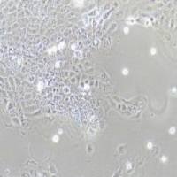 SCaBER人膀胱鳞癌细胞(提供STR鉴定报告)