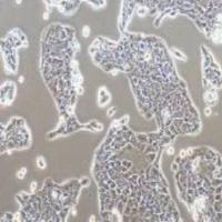 PANC10.05人胰腺癌细胞(提供STR鉴定报告)