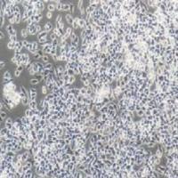 RKO人结肠腺癌细胞(提供STR鉴定报告)