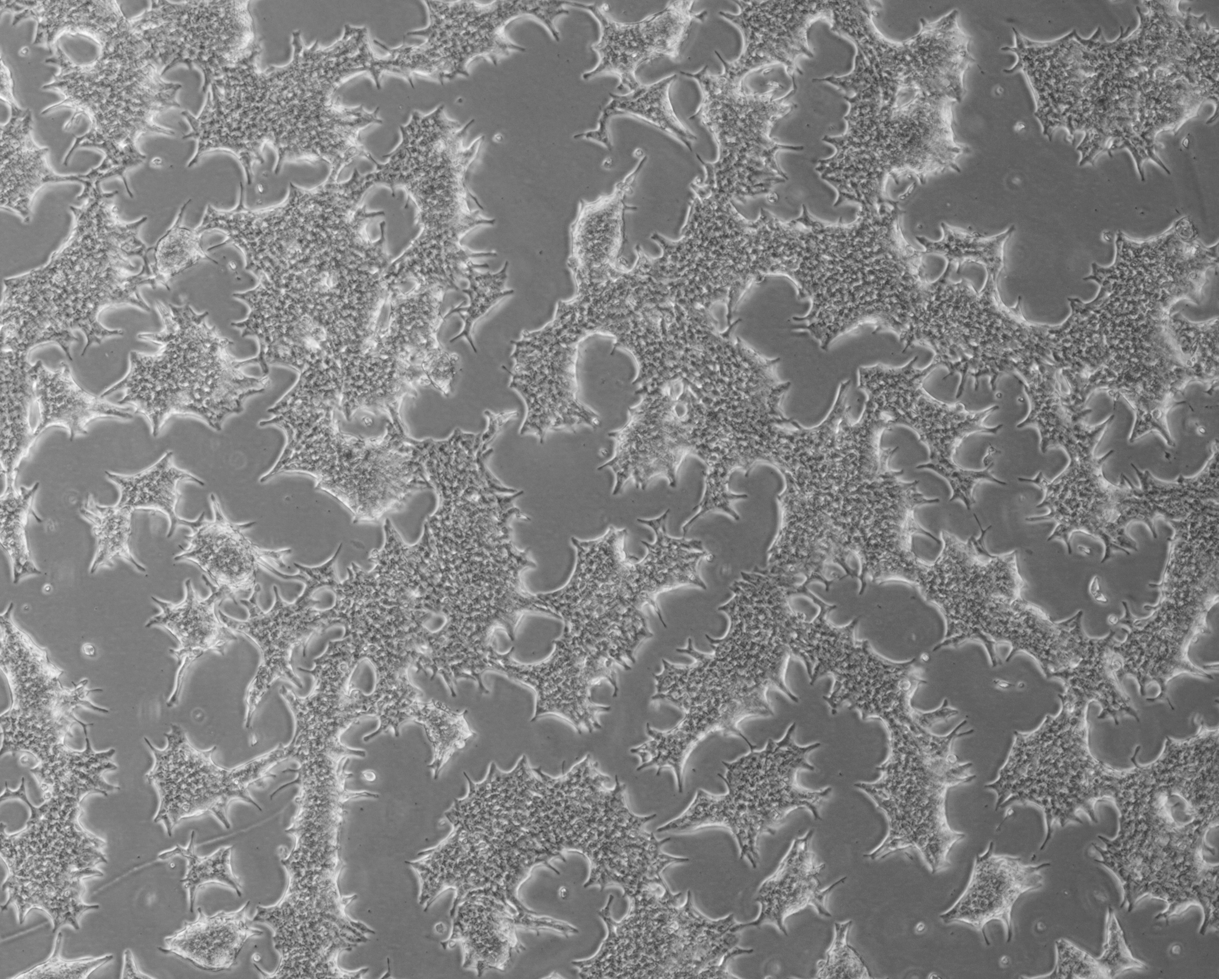 LNCaP clone FGC细胞培养攻略详解！ ​