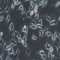 Saos-2人成骨肉瘤细胞(提供STR鉴定报告)