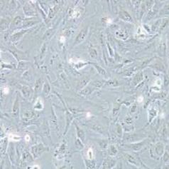 TJ905人胶质瘤细胞(提供STR鉴定报告)