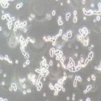 WERI-RB-1人视网膜神经胶质瘤细胞(提供STR鉴定报告)