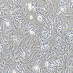 SNB-19人胶质瘤细胞(提供STR鉴定报告)