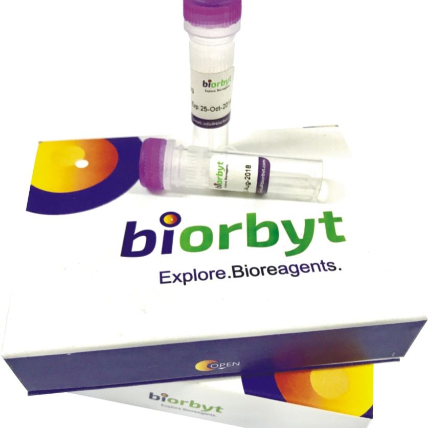 GLYCTK antibody 抗体 (Biotin)，orb719087，biorbyt