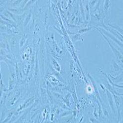 SW-1353人骨肉瘤细胞(提供STR鉴定报告)