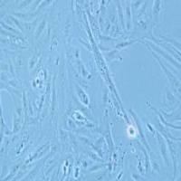 SW-1353人骨肉瘤细胞(提供STR鉴定报告)