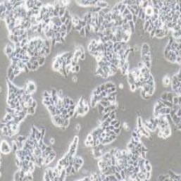 T47D人乳腺导管癌细胞(提供STR鉴定报告)