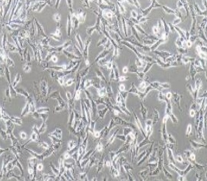 U251MG/TMZ人类星形胶质瘤耐替莫唑胺细胞