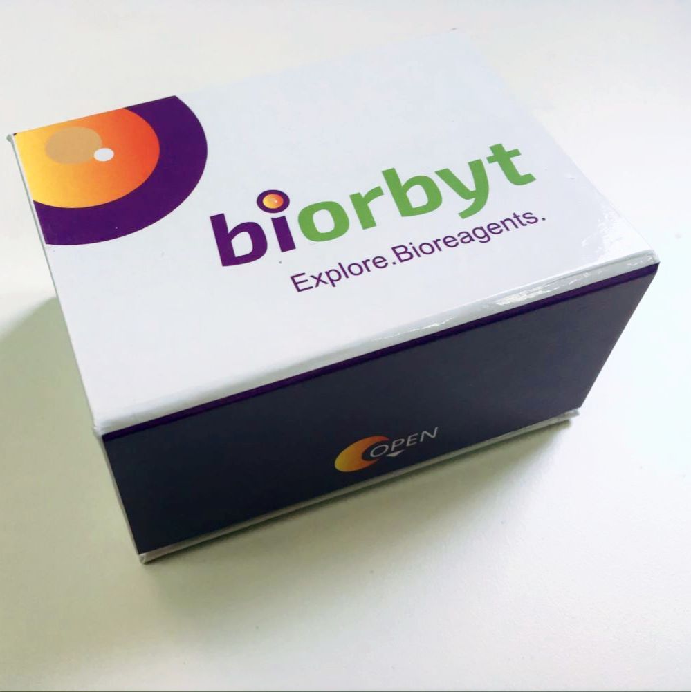 Human KMO ELISA Kit 酶联免疫试剂盒，orb778040，biorbyt