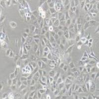 TU138人喉癌细胞(提供STR鉴定报告)