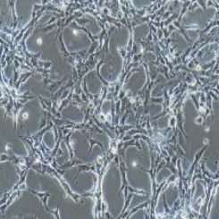 U87MG+RFP人脑星形胶质母细胞瘤+RFP