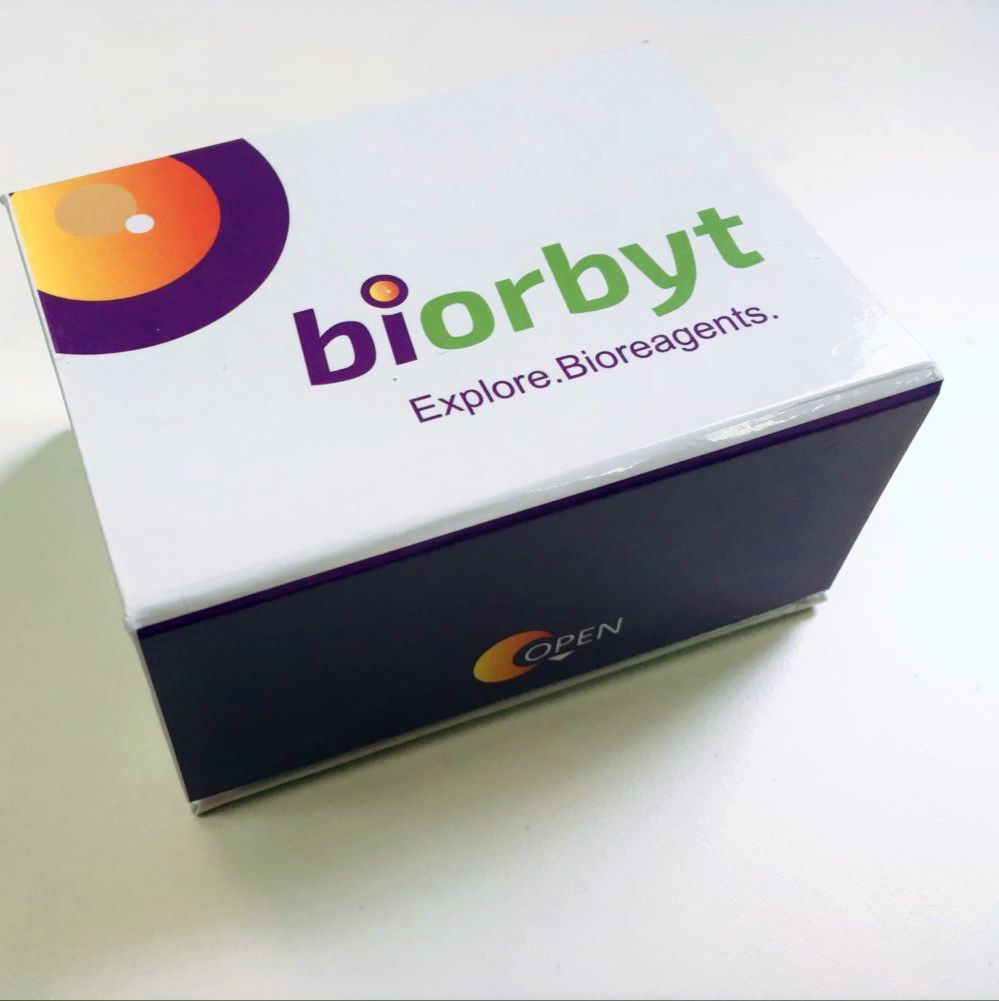 Mouse sRAGE ELISA Kit 酶联免疫试剂盒，orb782154，biorbyt