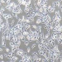 TT人甲状腺癌细胞(提供STR鉴定报告)