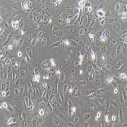 SV-HUC-1人输尿管上皮永生化细胞(提供STR鉴定报告)