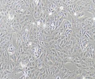T98G人胶质母细胞瘤(提供STR鉴定报告)