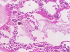 小鼠急性胰腺炎模型