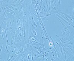 SW-1353人骨肉瘤细胞(提供STR鉴定报告)