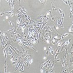 U2OS人骨肉瘤细胞(提供STR鉴定报告)