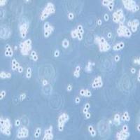 SNU-1人胃癌细胞(提供STR鉴定报告)