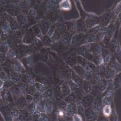 TPC-1人乳头状甲状腺癌细胞(提供STR鉴定报告)