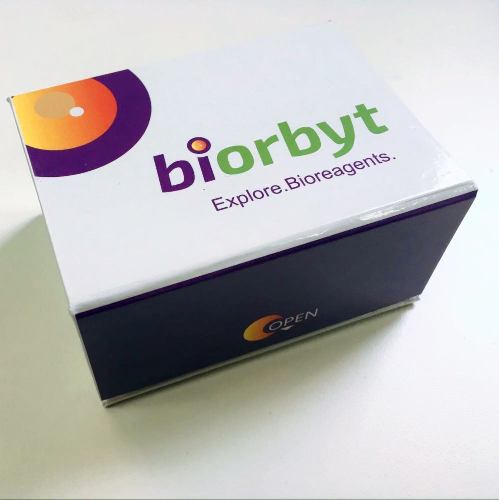 Biorbyt Plus (HRP) Anti-Mouse Bulk Kit, 1 Kit (125 ml/1,250 tests)，orb1087626，biorbyt