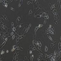 SW982人滑膜肉瘤细胞(提供STR鉴定报告)