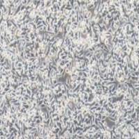 SW620人结直肠腺癌细胞(提供STR鉴定报告)