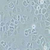 SW-13人肾上腺皮质癌细胞(提供STR鉴定报告)