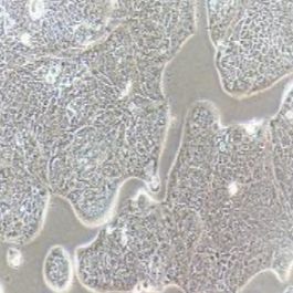 SW1116人结肠腺癌细胞(提供STR鉴定报告)