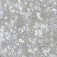 TE-1人食管癌细胞(提供STR鉴定报告)