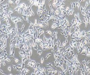 TT人甲状腺癌细胞(提供STR鉴定报告)