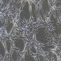 U87MG人脑星形胶质母细胞瘤(提供STR鉴定报告)